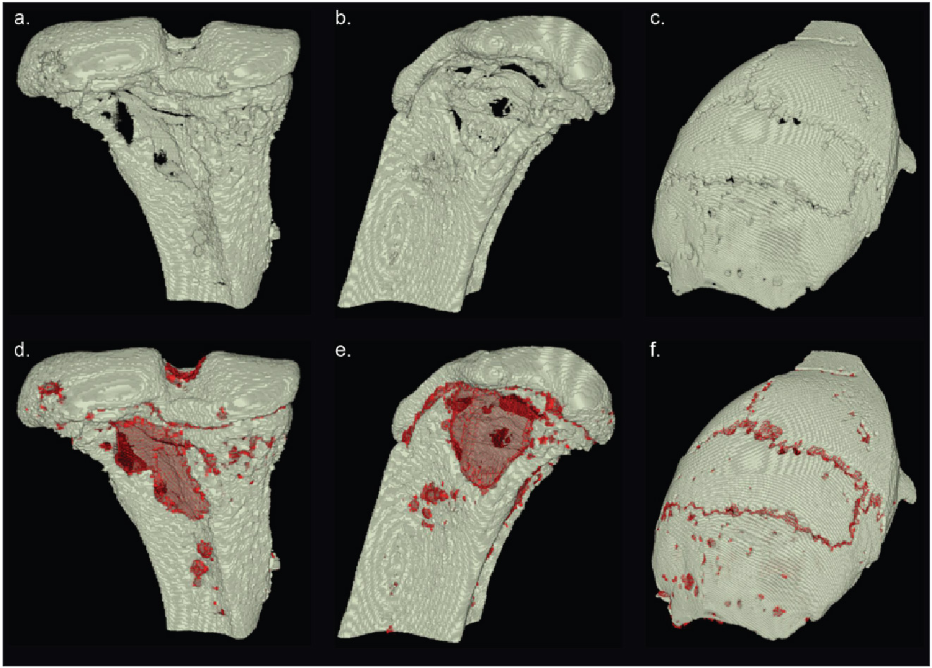 Reconstruction results