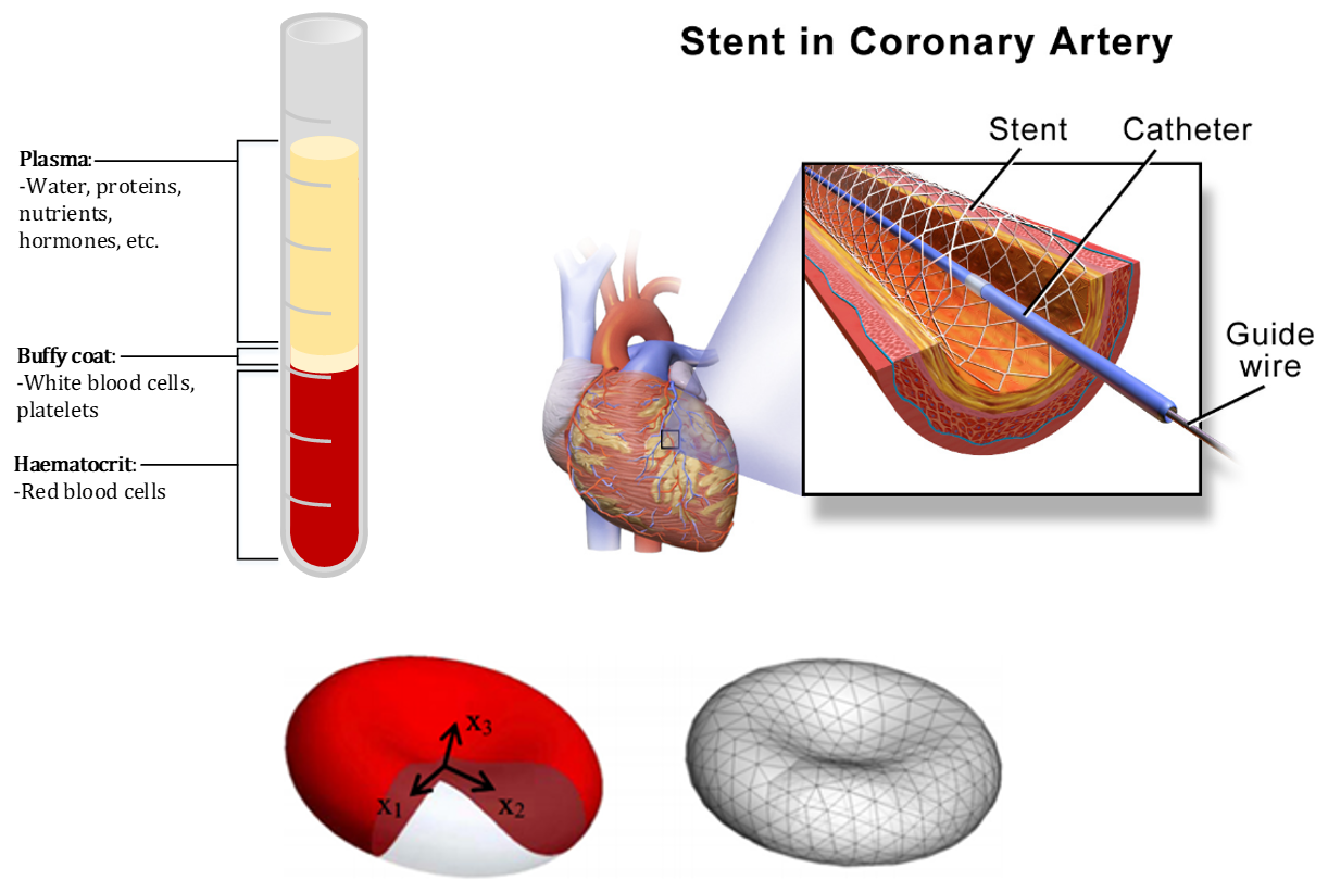 Healthy blood sample constituent diagram showing ~45% RBCs (top left), illustration of stent use (top right), and representation of RBC and equivalent discretised model (bottom) [1][2]